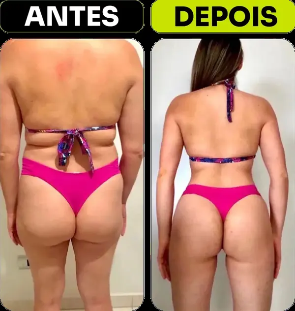 Antes e depois de aluna da equipe Will Portela